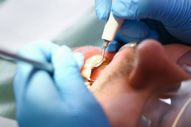 Best Emergency Root Canal Therapy in Lahoma City, OK