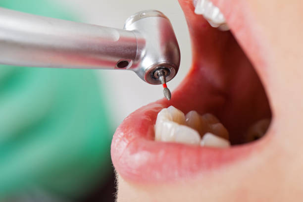 Best Emergency Dental Care for Sports Injuries in Lahoma City, OK